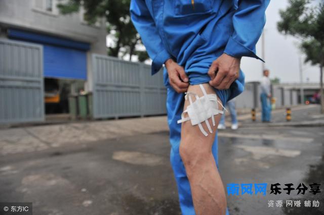 蜈蚣咬了怎么办(蜈蚣咬了怎么处理方法)